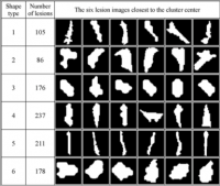 CSVD Biomarker characterisation CSVD Biomarker characterisation